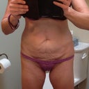 The dreaded "before" shots