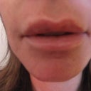 Trying to smile but my lips are still numb!