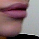 exactly one month after procedure