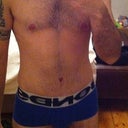 Post Op - 1 Month - Starting to look normal again!