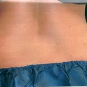 Before from back