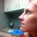 After - profile - 6 days post op