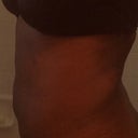 Day 6 post side. I had to take this pic myself, so I am turned to the side a bit