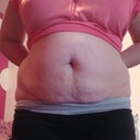 Pre-Procedure-Front