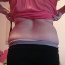 Pre-Procedure-Back side