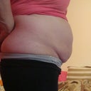 Pre-Procedure-Side view