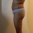 Totally No ASS and No LEGS