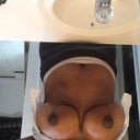 Swelling going down more and more each day :-)