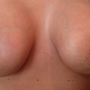 Almost 6 weeks post op