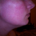 Profile before