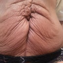 pre op
