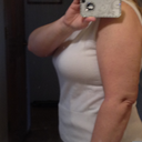 Arm at 7 weeks post lipo