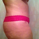 Right side 7 weeks