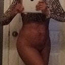 4 MO POST OP