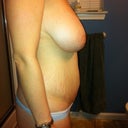 Pre Op