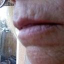 before and after pictures