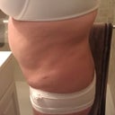 Before side view