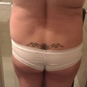 Before back view