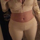 10 days post op, scars from gastic sleeve, I need a tan!