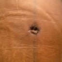 close up of my belly button. I love it because it is my real belly button lol. 4 day post op