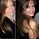 Before and After!!  The after (on the right) was taken 5 weeks postop.