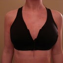 About 12 hours after surgery. These pics aren't great and the bra makes them look smaller than they do in real life, but it's the best I can do tonight. :)
