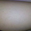 This is approximately a year after my last treatment.  I would say that now I have slightly more than that... but still significantly less than what I started out with.  I will write an update if anything changes.
