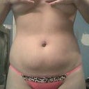 Front view ( before brazilian butt lift )