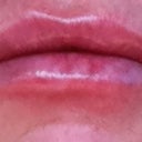 30 minutes after procedure