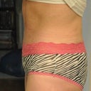 3 week side view.
