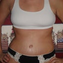 16 days Post OP