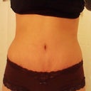 2 wks 5 days