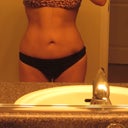 7 weeks post op