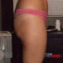 Pre Surgery Side