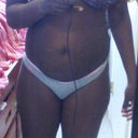 Pre-op