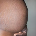 Stomach after 2 C-sections...gotta love the kids...