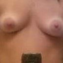 before: droopy breast tissue, large areolas. and chicken cutlets! :""""""(