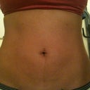 4 weeks post procedure