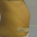 the bulge is more obvious after i stand up from laying down then it settles down and it shows less