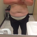 About two months after treatment. So far, I've had two on the upper abdomen and two on the lower. I will post side views very soon! The photos are on my old phone, so I have to pull the memory card.