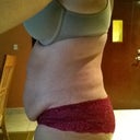 Pre op
