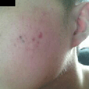 left cheek