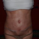 5 weeks PO