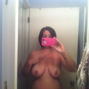 3 weeks post op