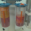 This is how much fat they took out my abs and braline/back area.--- approximately 2300 cc