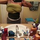 front post op garment