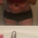 swelling going down but I still have to walk bent over ugh