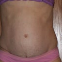 5 months--see the bulge? It is not flat anymore!
