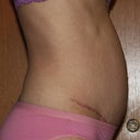 5 months