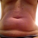 Found a better before pic of loose skin.